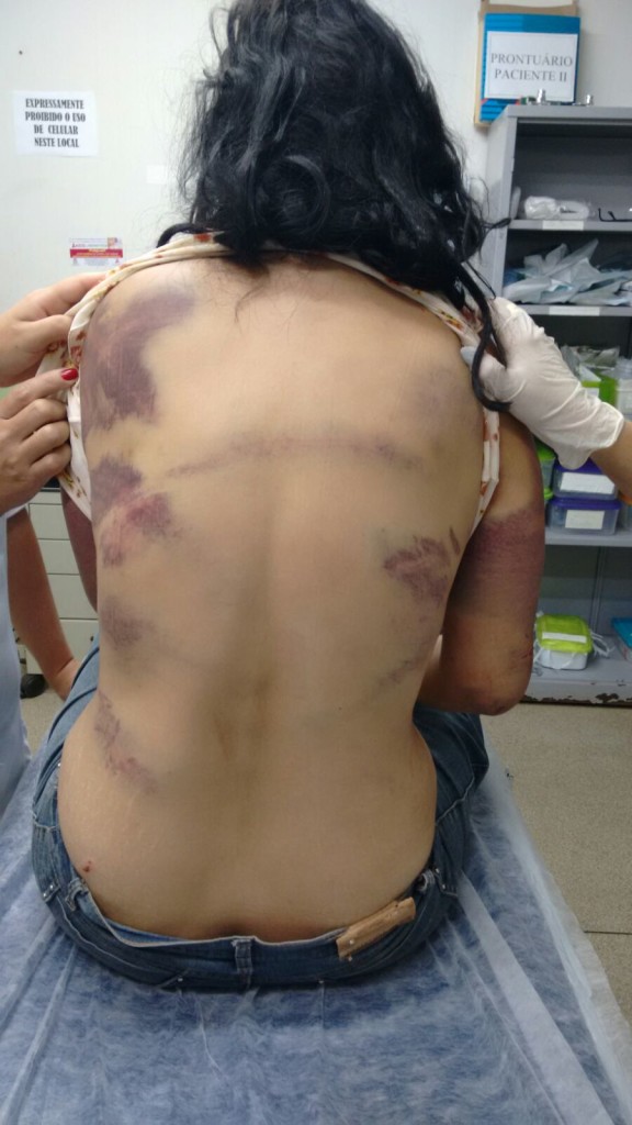 Mulher de 41 anos é torturada e mantida em cárcere privado pelo marido (Foto WEB TV Araguari)