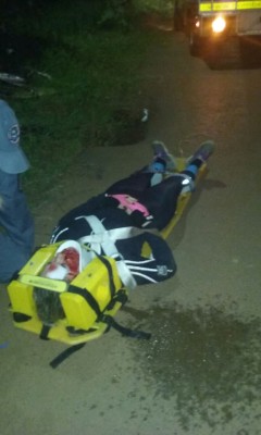 Jovem sofreu traumatismo craniano, convulsões e teve fraturas no maxilar