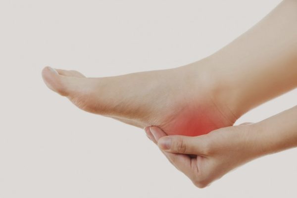 Esporão do calcâneo