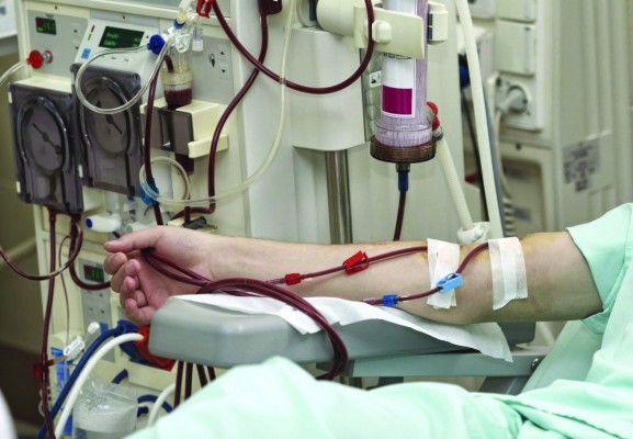 Cada sessão de hemodiálise custa R$ 280 e repasse do Governo Federal é de R$ 194