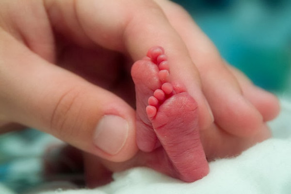 17 de novembro é comemorado o Dia Mundial da Prematuridade