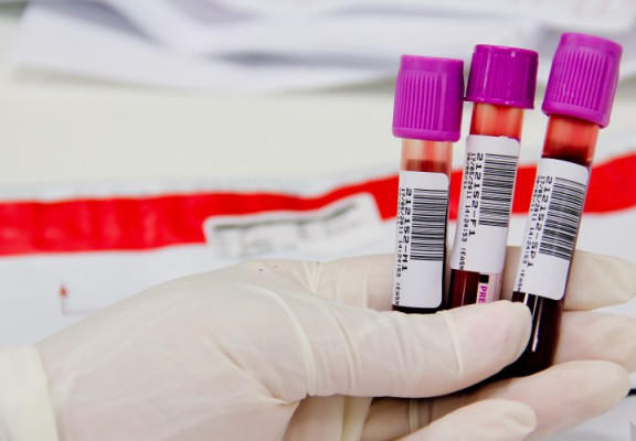 Exames laboratoriais devem ser retomados em breve