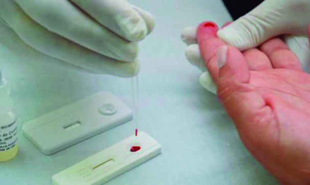 O CAE distribui preservativos e faz testagens rápidas gratuitamente  **Divulgação 