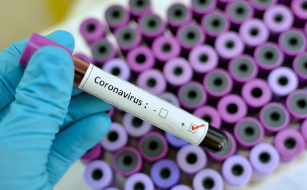 Boletim epidemiológico divulgado pela SES-MG informou mais dois casos suspeitos de Coronavírus em Araguari