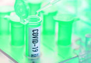 Números relacionados ao novo coronavirus aumentam gradativamente em Araguari e região